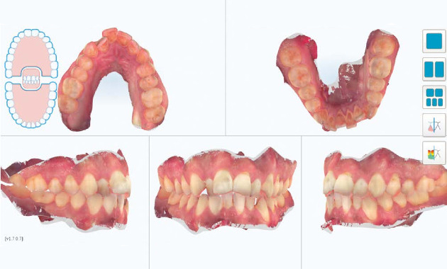 dentition numérique