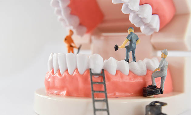 Dentier en travaux